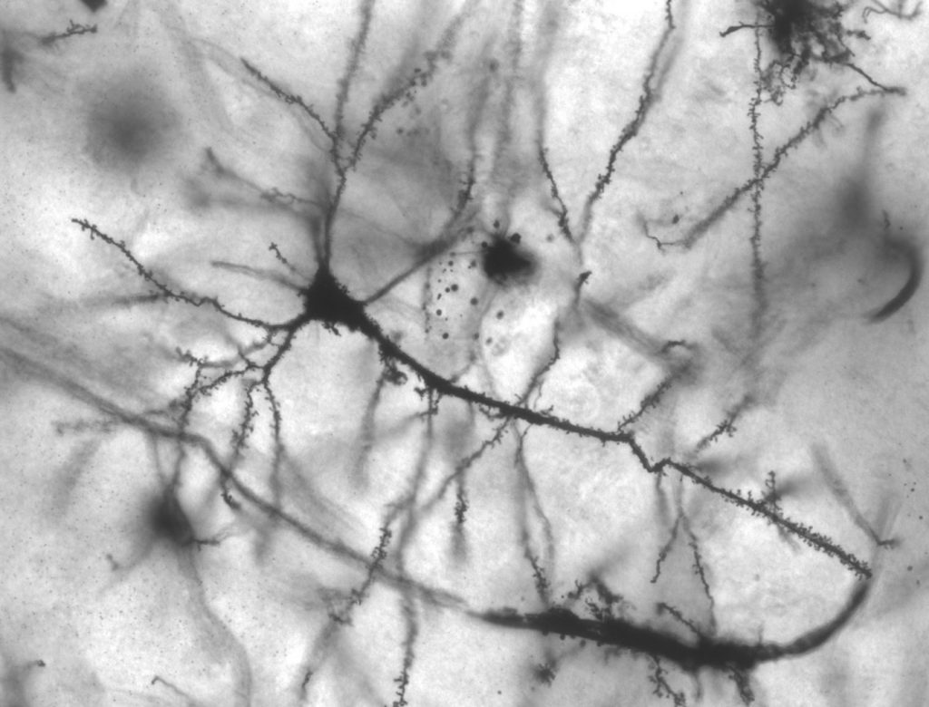 Microphotographie de neurone du noyau pyramidal de l'hippocampe